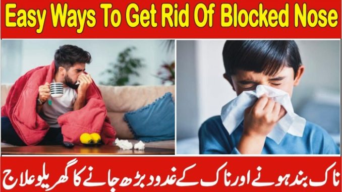 Easy Ways To Get Rid Of Blocked Nose