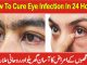 How To Cure Eye Infection In 24 Hours